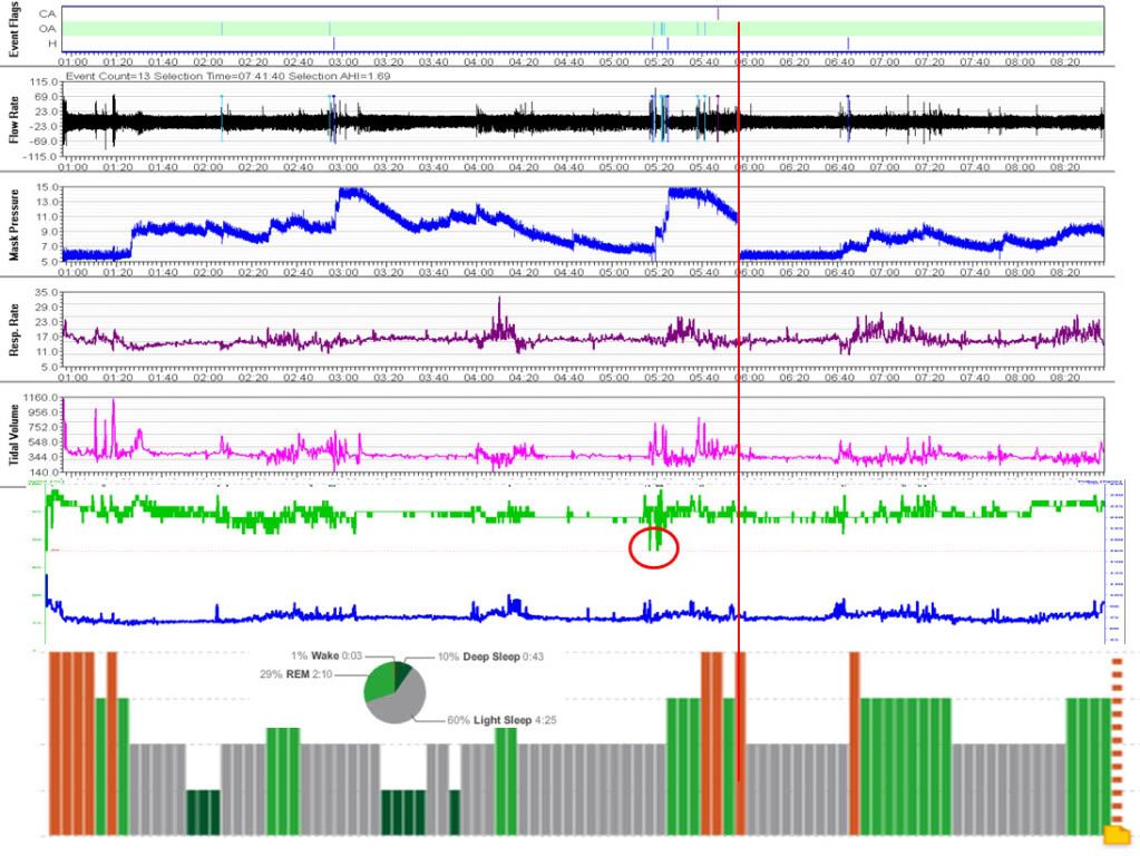 Here's mine, where I screen shot from SleepyHead, CMS 50E viewer and Zeo web and align them in PowerPoint by eye: